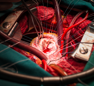 Ürək-damar cərrahiyyəsi